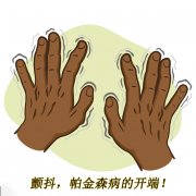 顫抖，帕金森病的開端 帕金森的癥狀有哪些